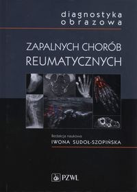 Diagnostyka obrazowa zapalnych chorób reumatycznych