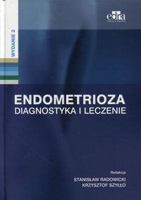 Endometrioza Diagnostyka i leczenie