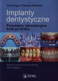 Implanty dentystyczne