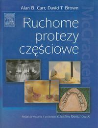 Ruchome protezy częściowe