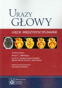 Urazy głowy