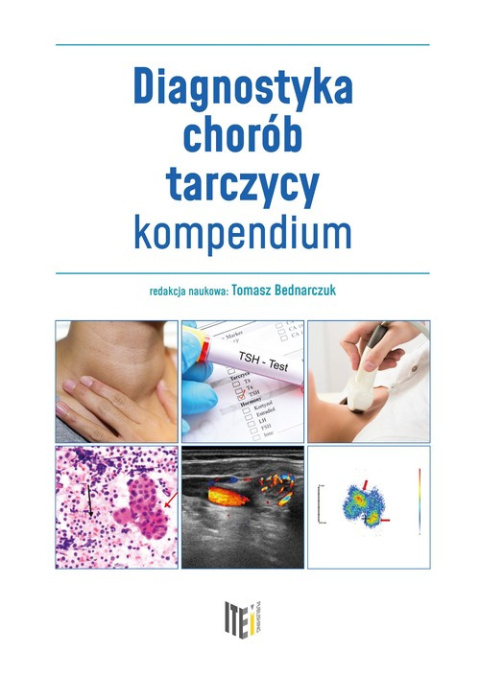 Diagnostyka chorób tarczycy kompendium