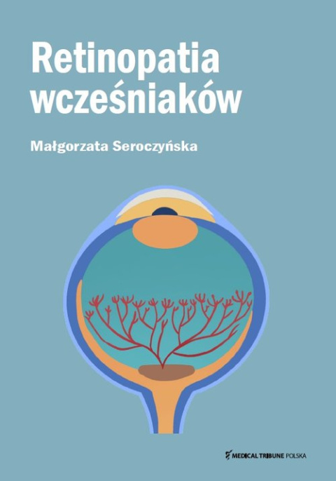 Retinopatia wcześniaków