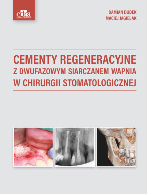 Cementy regeneracyjne z dwufazowym siarczanem wapnia w chirurgii stomatologicznej