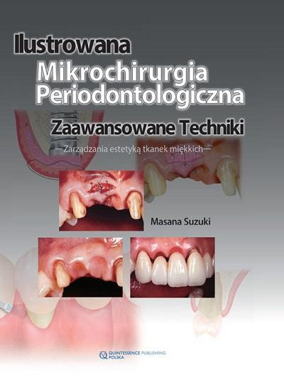 Ilustrowana mikrochirurgia periodontologiczna