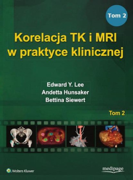 Korelacja TK i MRI w praktyce klinicznej Tom 2