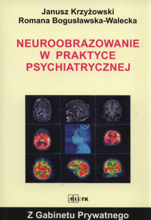 Neuroobrazowanie w praktyce psychiatrycznej