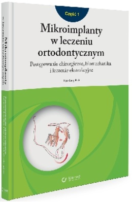 Mikroimplanty w leczeniu ortodontycznym Część 1