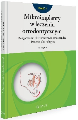 Mikroimplanty w leczeniu ortodontycznym Część 1