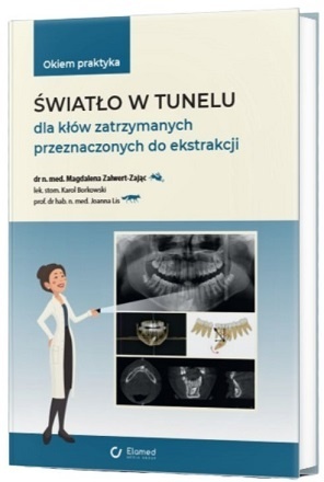 Okiem praktyka: światło w tunelu dla kłów zatrzymanych przeznaczonych do ekstrakcji