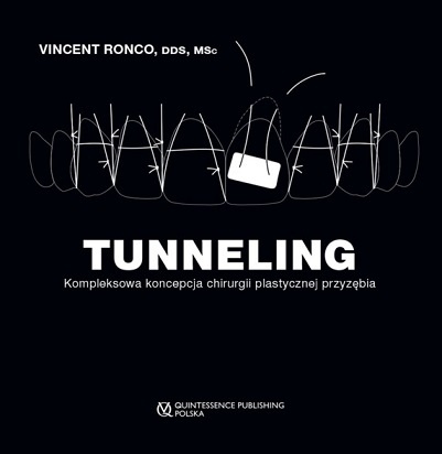 TUNNELING Kompleksowa koncepcja chirurgii plastycznej przyzębia