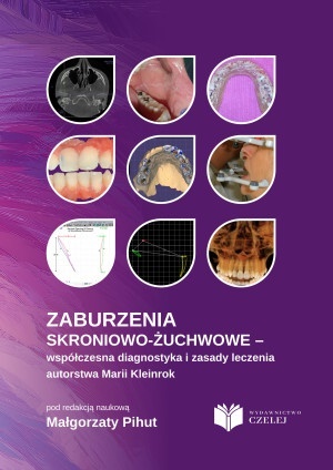Zaburzenia skroniowo-żuchwowe – współczesna diagnostyka i zasady leczenia