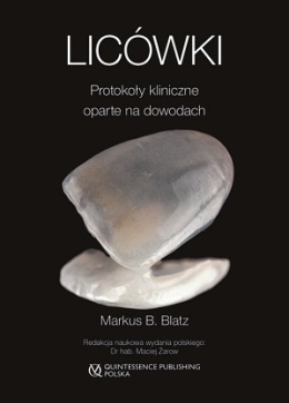 Licówki