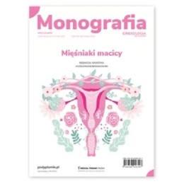 Monografia. Mięśniaki macicy