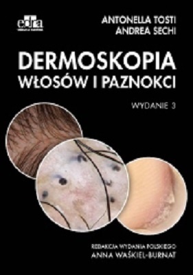Dermoskopia włosów i paznokci