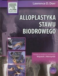 Alloplastyka stawu biodrowego z płytą DVD