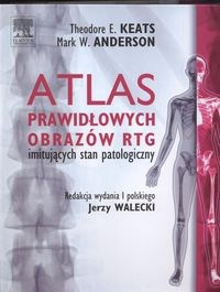 Atlas prawidłowych obrazów RTG imitujących stan patologiczny