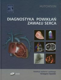 Diagnostyka powikłań zawału serca