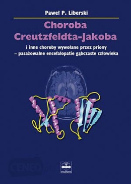 Choroba Creutzfeldta-Jakoba i inne choroby wywołane przez priony - pasażowalne encefalopatie gąbczaste człowieka