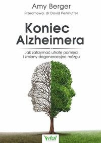 Koniec Alzheimera