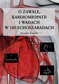 O zawale kardiomiopatii i wadach w 100 echoszaradach