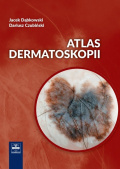 Atlas dermatoskopii