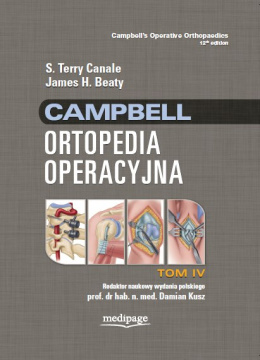 CAMPBELL ORTOPEDIA OPERACYJNA TOM 4, S. TERRY CANALE, JAMES H. BEATY