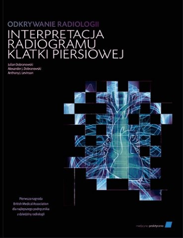 Odkrywanie radiologii: interpretacja radiogramu klatki piersiowej