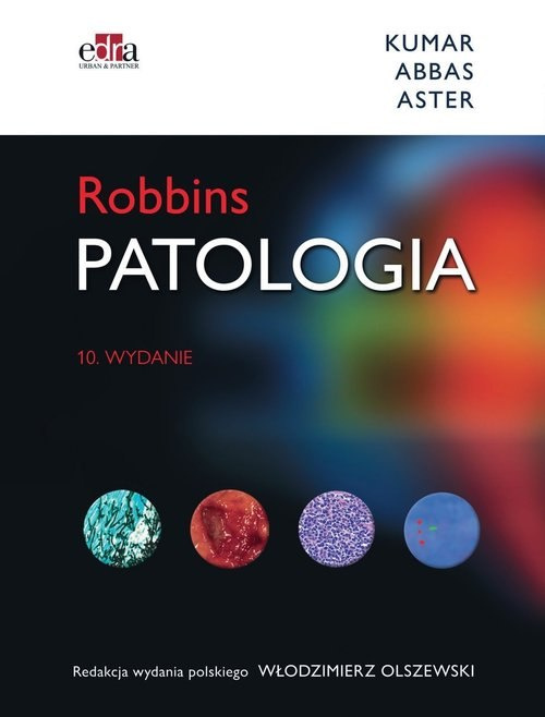 Patologia Robbins