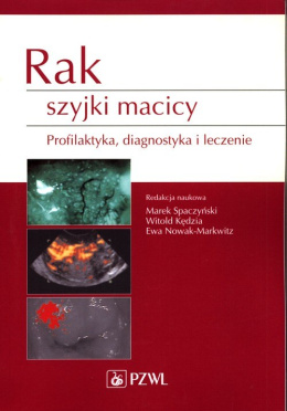 Rak szyjki macicy