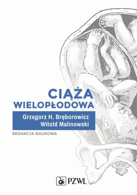 Ciąża wielopłodowa