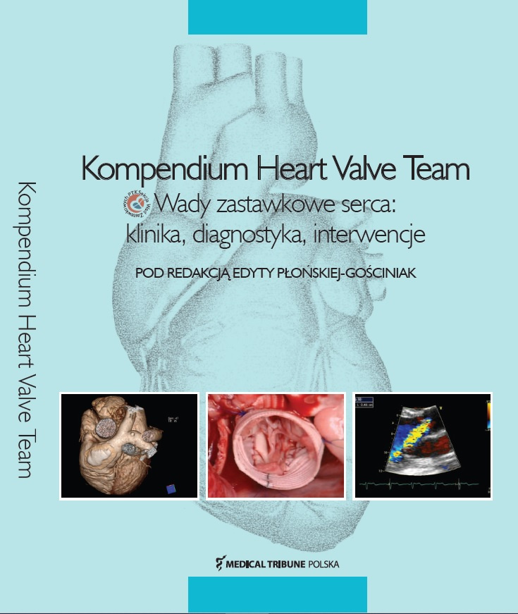 Kompendium Heart Valve Team. Wady zastawkowe serca: klinika, diagnostyka, interwencje