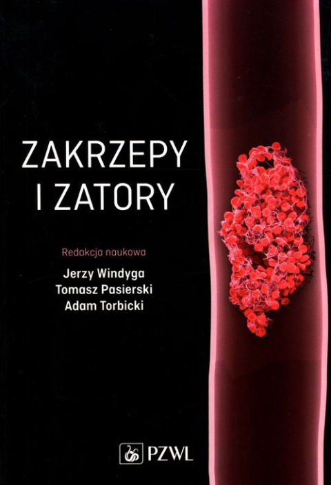 Zakrzepy i zatory