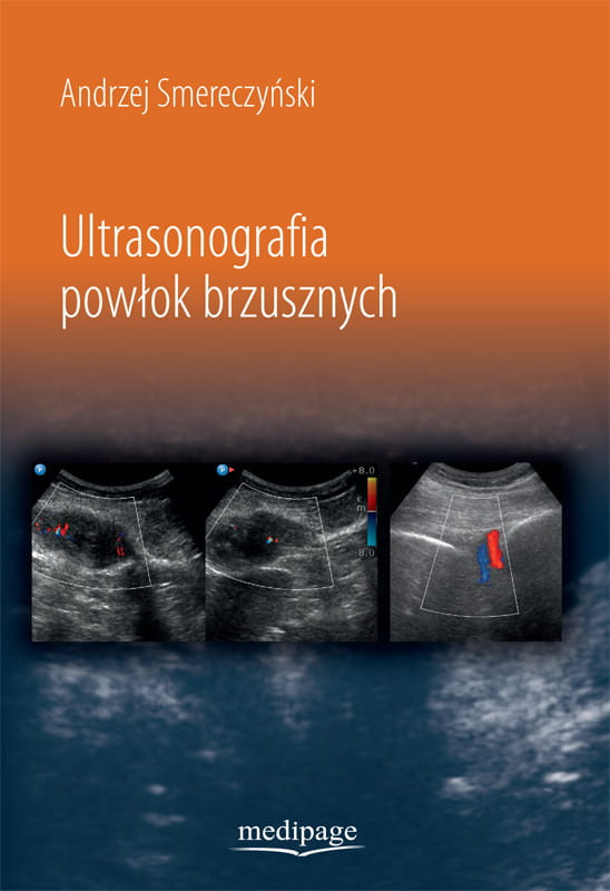 Ultrasonografia powłok brzusznych