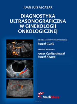 Diagnostyka ultrasonograficzna w ginekologii onkologicznej