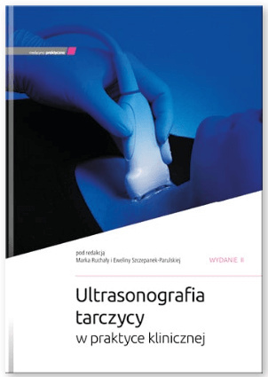 Ultrasonografia tarczycy w praktyce klinicznej wyd. 2