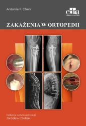 Zakażenia w ortopedii