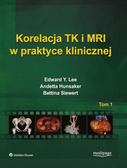 Korelacja TK i MRI w praktyce klinicznej Tom 1
