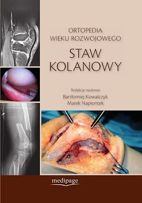 Ortopedia wieku rozwojowego. Staw kolanowy